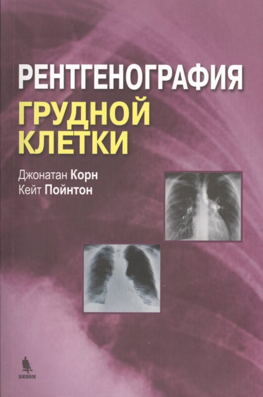 Рентгенография грудной клетки
