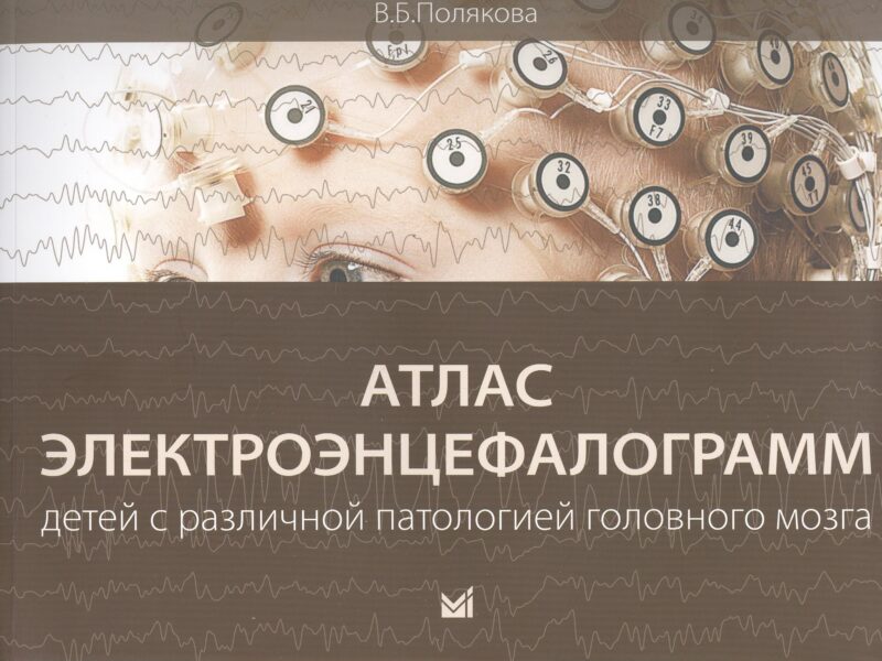 Атлас электроэнцефалограмм детей с различной патологией головного мозга