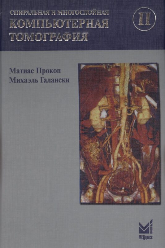 Спиральная и многослойная компьютерная томография. Том 2. Учебное пособие