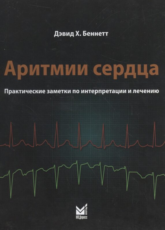 Аритмии сердца. Практические заметки по интерпретации и лече