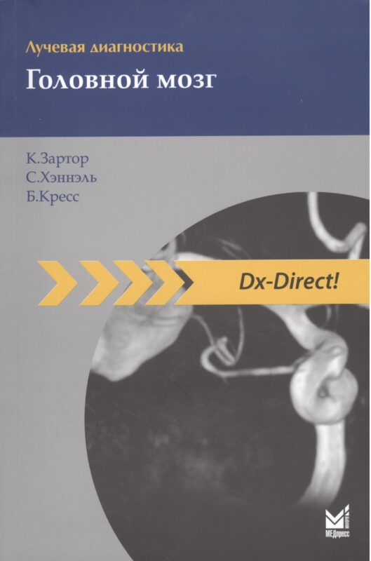 Лучевая диагностика. Головной мозг