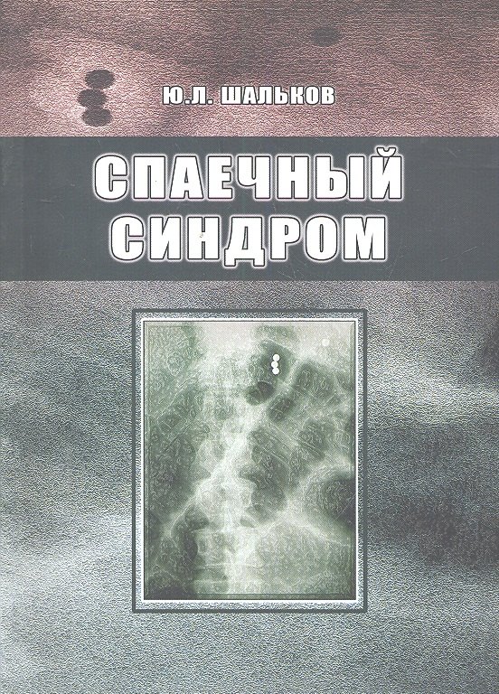 Спаечный синдром.