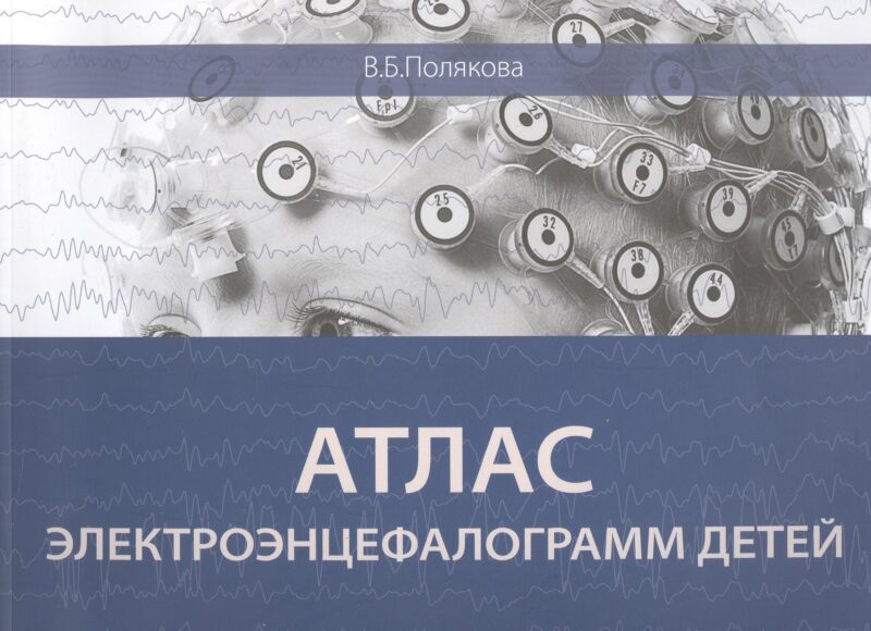 Атлас электроэнцефалограмм детей