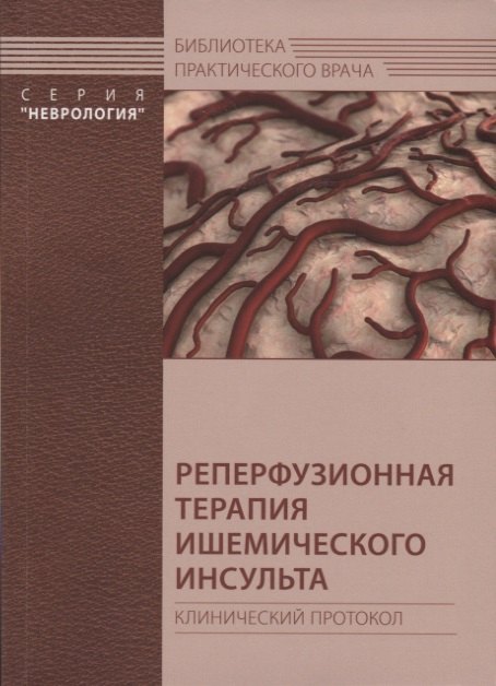 Реперфузионная терапия ишемического инсульта. Клинический протокол