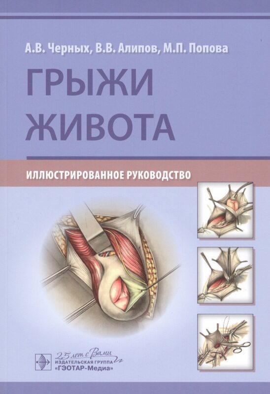 Грыжи живота: Иллюстрированное руководство