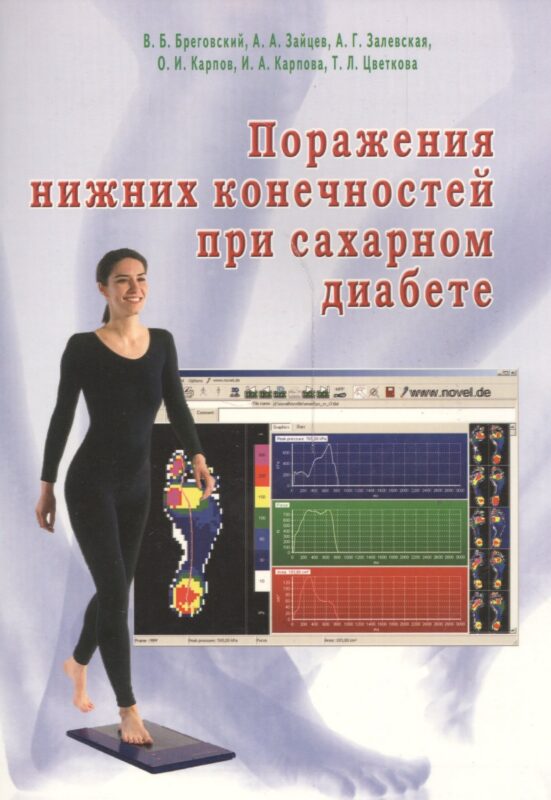 Поражения нижних конечностей при сахарном диабете