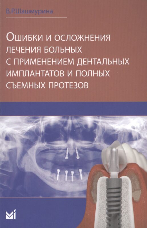 Ошибки и осложнения лечения больных с применением дентальных