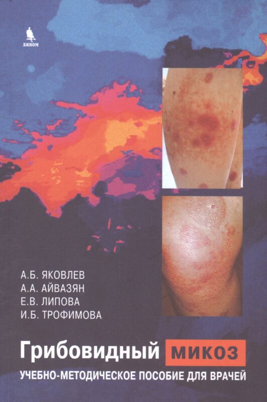 Грибовидный микоз. Учебно-методическое пособие для врачей