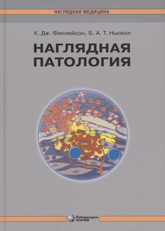 Наглядная патология