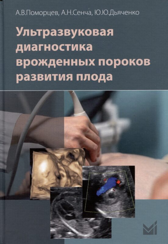 Ультразвуковая диагностика врожденных пороков развития плода