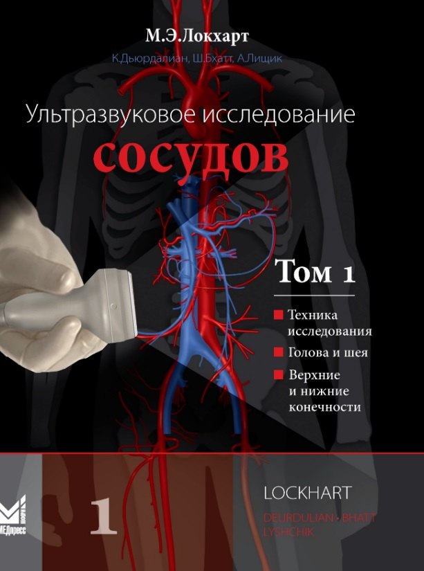 Ультразвуковое исследование сосудов. Том 1