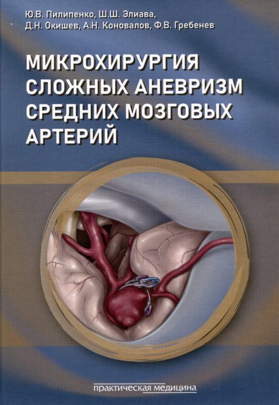 Микрохирургия сложных аневризм средних мозговых артерий: крупных, гигантских, фузиформных и частично тромбированных