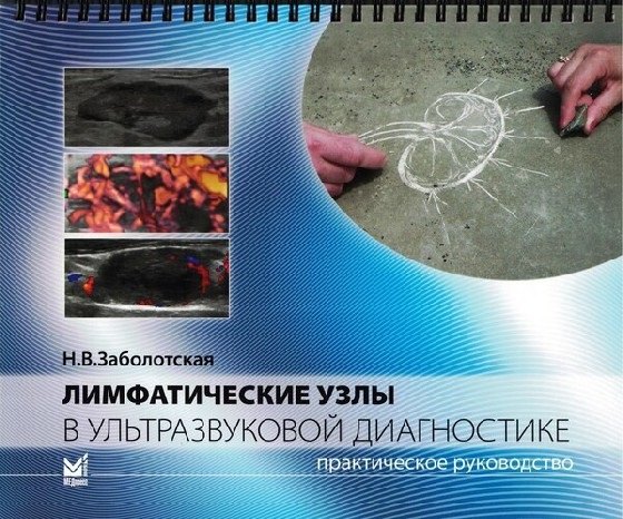 Лимфатические узлы в ультразвуковой диагностике