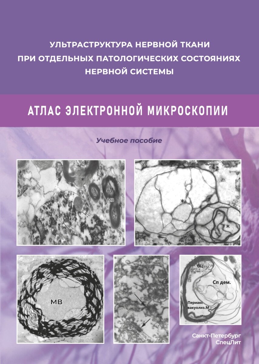 Ульстраструктура нервной ткани при отдельных патологических состояниях нервной системы. Атлас электронной микроскопии.